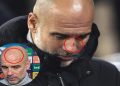 guardiola-clarifies-comments-on-self-harm-after-post-match-joke-about-scratches-on-his-face