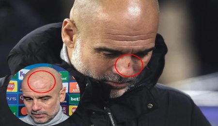 Guardiola Clarifies Comments on Self-Harm After Post-Match Joke About Scratches On His Face guardiola-clarifies-comments-on-self-harm-after-post-match-joke-about-scratches-on-his-face