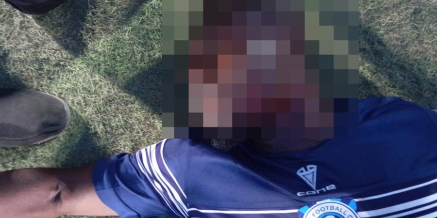 Barau FC Player Stabbed In Neck During NPFL Match Against Katsina United barau-fc-player-stabbed-in-neck-during-npfl-match-against-katsina-united